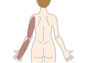 頸椎椎間関節由来の痛み・痺れの範囲：上腕後面〜前腕後面〜手指背側の症状