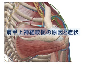 肩甲上神経絞扼の原因と症状のトップ画像