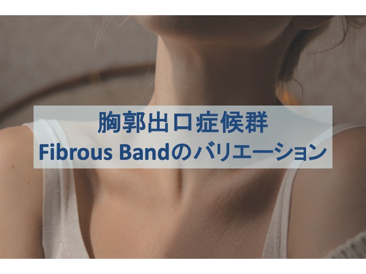 胸郭出口症候群：Fibrous Bandのバリエーションのトップ画像