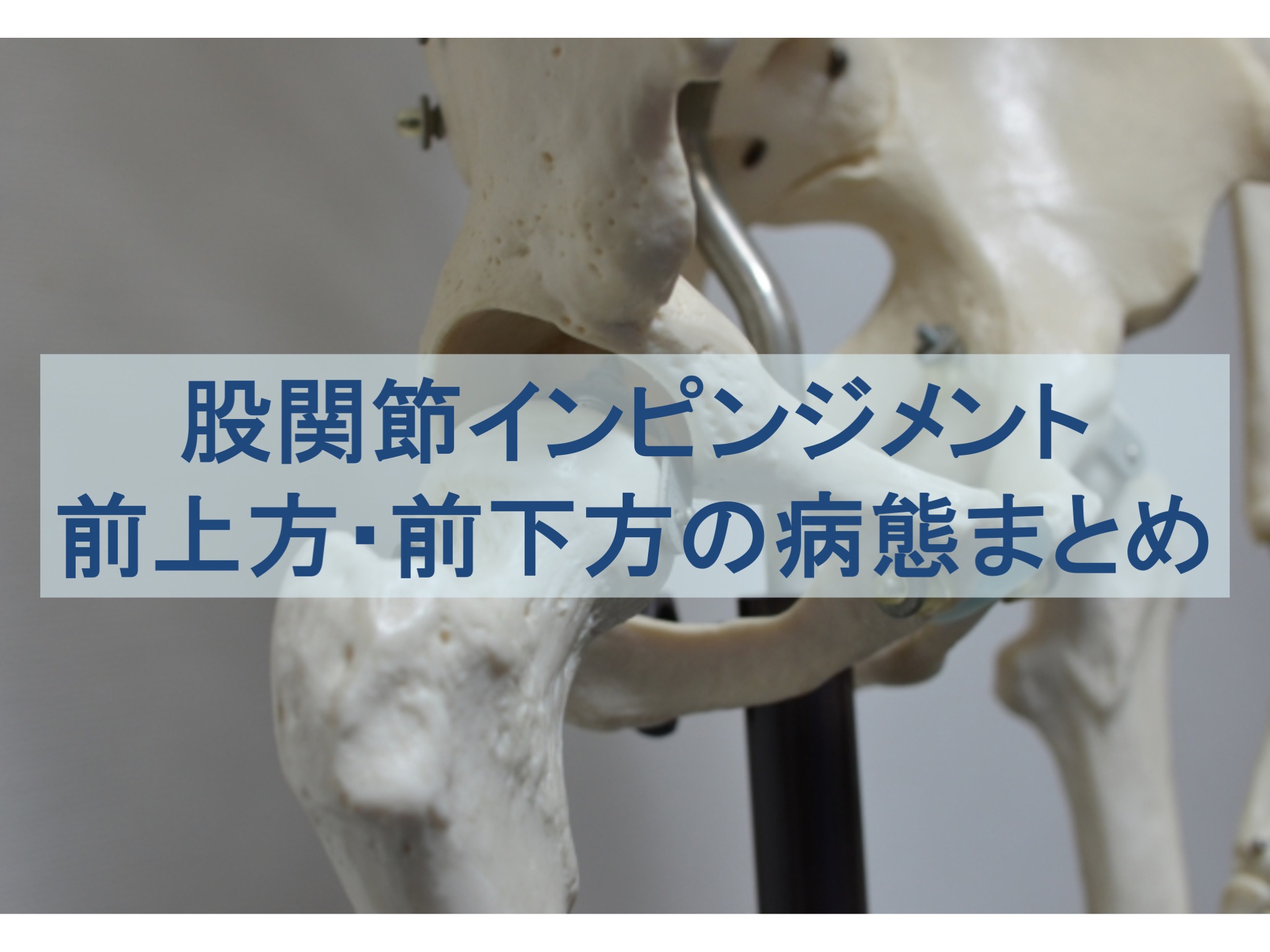 股関節前上方インピンジメントと股関節前下方インピンジメントの病態の記事のトップ画像
